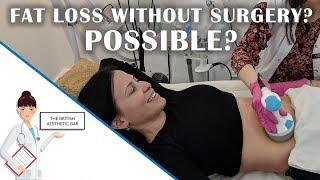 Non Surgical Tummy Tuck in London | Full Procedure