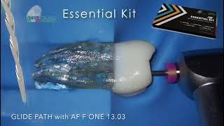 Operative sequence of the #FOneEssentialKit Fanta selected by Styleitaliano Endodontics！