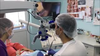 Сolor composite in the preparation, for good visualization. tooth preparation