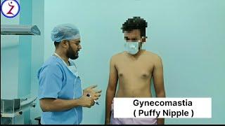 Gynecomastia Surgery In Raipur Nagpur Ahmedabad Bhopal Lucknow Surat Jaipur Kolkata Bangalore Indore