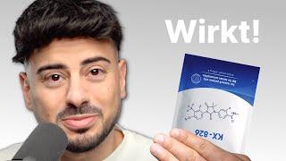 Top 3 Geheime & wirksame Anti Haarausfall Mittel die nur Promis nutzen