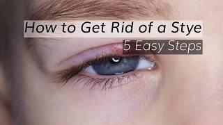 Eye Stye Treatment: How to Get Rid of A Stye in 5 Steps