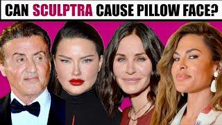 Can Sculptra Migrate and cause Pillow Face- What if I don't like my results?