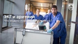 ЭКГ и аритмии: что можно извлечь из монитора?