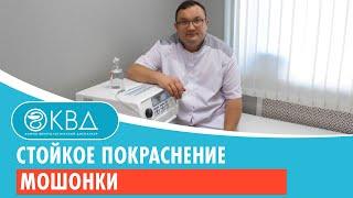  Стойкое покраснение мошонки. Клинический случай №947