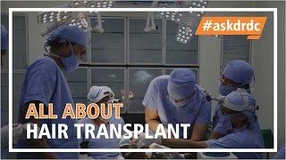 All About-Hair Transplant | HairMD, Pune