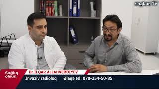 İNVAZİV RADİOLOQ İLQAR ALLAHVERDİYEV. EKSKLUZİV MUSAHİBE. SAĞLIQ OLSUN LAYİHESİ. SAGLAM TV