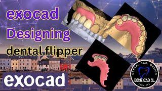 ExoCad dental flipper design