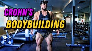 Crohn’s & Bodybuilding?! Day 148 cutting.