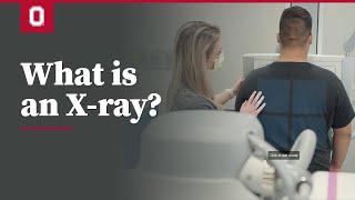 What is an X-ray? | Ohio State Medical Center
