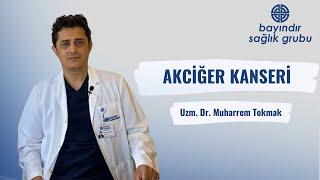 Akciğer Kanseri