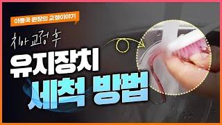 치아교정 후, 유지장치 세척 & 관리 방법 - 가철식 유지장치 편