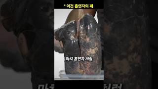 달리기 잘못하면 폐가 이렇게 됩니다..ㅠ