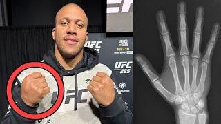 Ciryl Gane HAND INJURY FEAR Before UFC 285 vs Jon Jones - Doctor Explains