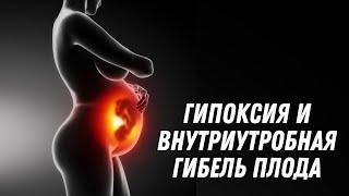 ГИПОКСИЯ И ВНУТРИУТРОБНАЯ ГИБЕЛЬ ПЛОДА @DrOlenaB #гипоксия #беременность #olenaberezovska