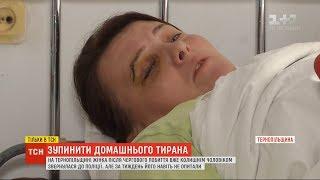 Поліція на Тернопільщині ігнорує регулярні побиття жінки її колишнім чоловіком