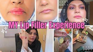 My Lip/Smile line Filler Experience | Bakery Style Ceramel Cake 4 Winter |   Winter Lipstick Colour