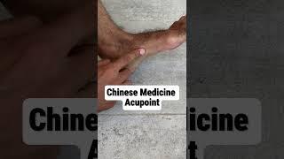 Chinese Medicine Acupoint