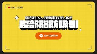 【脂肪吸引NO.1狎鴎亭TOPLINE】腹部脂肪吸引REAL REVIEW!!