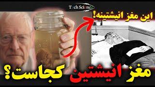 آلبرت انیشتین : تفاوت مغز انیشتین با بقیه آدم ها چیه؟