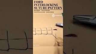 Ford Interlocking Suture Pattern (Lock Stitch) #shorts #medical #suture #suturing #training