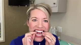 Teeth Whitening Instructions