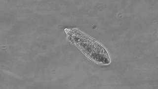 Schistosoma Mansoni Miracidium Swimming