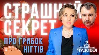 Ви позбудетесь цього назавжди ! Лікар Василь Чайка дає найкращий засіб проти грибка! Грибок нігтів.