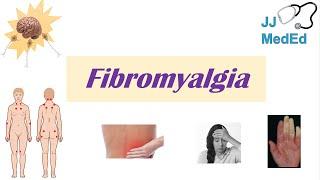 Fibromyalgia | Symptoms, Associated Conditions, Diagnosis, Treatment