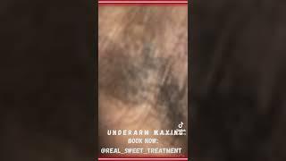 Wax of the day! Underarm Waxing! #wax #skincare #summer #bodywax #waxtips