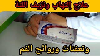 Bispirazol #لعلاج تعفنات الفم والأسنان ونزيف اللثة