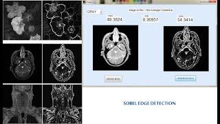 FPGA implementation of low power and high speed image edge detection algorithm