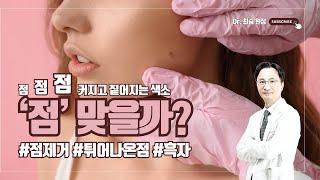 점 점 점 커지고 짙어지는 #색소 #점 맞을까 #닥터최승 #점제거 #점빼기 #붉은점 #잡티
