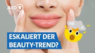 Hyaluron, Botox & Co. wie gefährlich sind die Nebenwirkungen? | Markt WDR