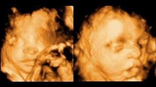 Princess Mia's 4D Ultrasound