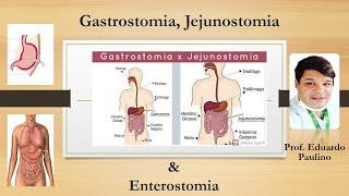 Gastrostomia, Jejunostomia e Enterostomia - Prof. Eduardo Paulino