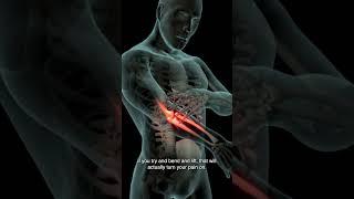 Are Brachioradilais Trigger Points Causing Your Wrist And Elbow Pain?