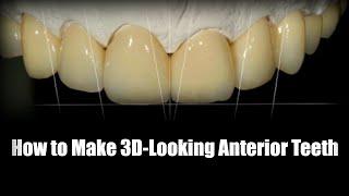 How to Make 3-Dimensional Looking Anterior Teeth