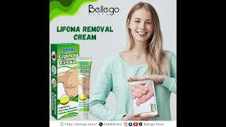 "Lipoma Removal Cream: Your Path to Smooth, Bump-Free Skin!"