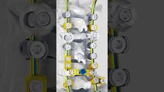 DEJO-Media - Aesculap - Ennovate® - Spine Days - 3D-Animation - Messevideo - short