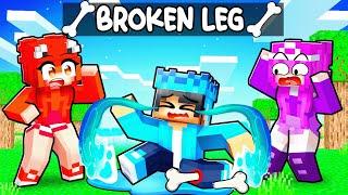 Shad BROKE A BONE in Minecraft..