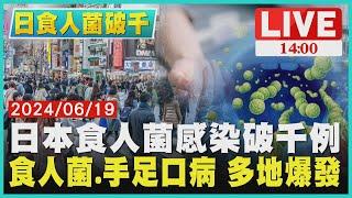 日本食人菌感染破千例　食人菌.手足口病 多地爆發LIVE｜1400 日食人菌破千｜TVBS新聞