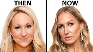 Nikki Glaser's NEW FACE | Plastic Surgery Analysis