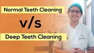 Deep Teeth Cleaning कब, क्यू और कैसे करते है?