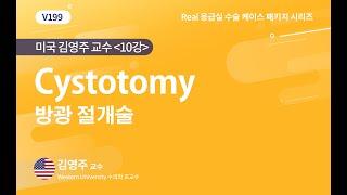 [베터플릭스] Cystotomy 방광절개술_수술