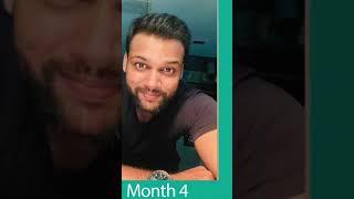 {2024 }  New Hair Day 2 to Day 210 Results #hairtransplant |  #shorts