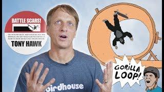 The Worst Injuries Of Tony Hawk's Career | Battle Scars