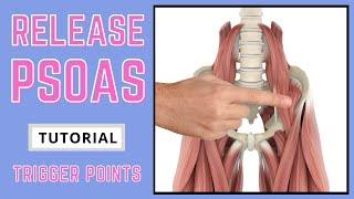 Trigger Point Release - Iliopsoas (Psoas)