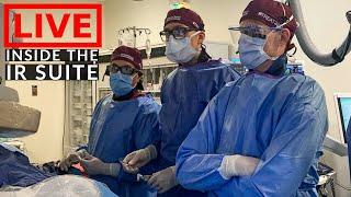 LIVE Procedure + BTS - Day in the Life of a DOCTOR - Interventional Radiology