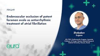 Endovascular occlusion of patent foramen ovale as antiarrhythmic treatment of atrial fibrillation
